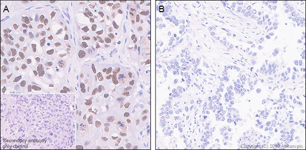 Immunohistochemistry (Formalin/PFA-fixed paraffin-embedded sections) - Anti-p40 - DeltaNp63 antibody [EPR17863-47] - BSA and Azide free (AB269956)