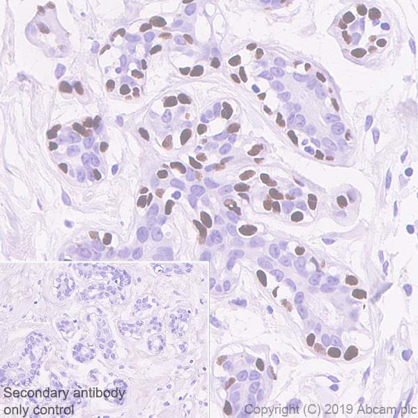 Immunohistochemistry (Formalin/PFA-fixed paraffin-embedded sections) - Anti-p40 - DeltaNp63 antibody [EPR17863-47] - BSA and Azide free (ab269956), expandable thumbnail