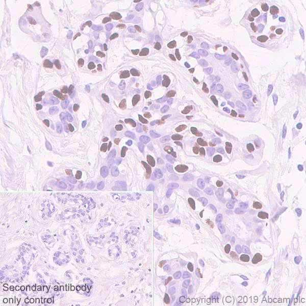 Immunohistochemistry (Formalin/PFA-fixed paraffin-embedded sections) - Anti-p40 - DeltaNp63 antibody [EPR17863-47] - BSA and Azide free (AB269956)