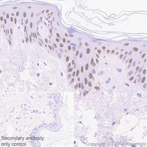 Immunohistochemistry (Formalin/PFA-fixed paraffin-embedded sections) - Anti-p40 - DeltaNp63 antibody [EPR17863-47] - BSA and Azide free (ab269956), expandable thumbnail