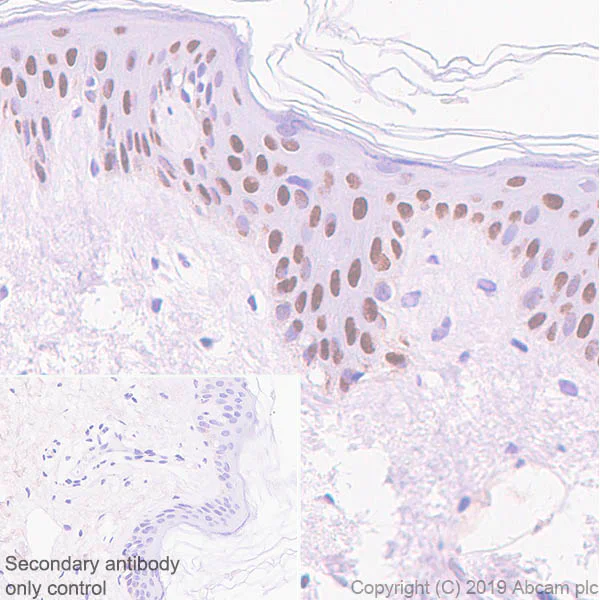 Immunohistochemistry (Formalin/PFA-fixed paraffin-embedded sections) - Anti-p40 - DeltaNp63 antibody [EPR17863-47] - BSA and Azide free (AB269956)