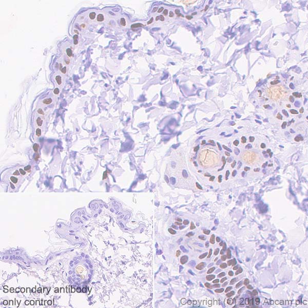 Immunohistochemistry (Formalin/PFA-fixed paraffin-embedded sections) - Anti-p40 - DeltaNp63 antibody [EPR17863-47] - BSA and Azide free (AB269956), expandable thumbnail