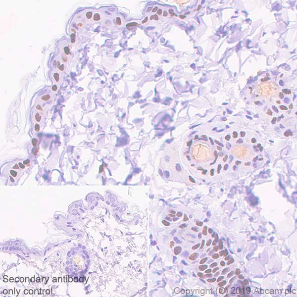 Immunohistochemistry (Formalin/PFA-fixed paraffin-embedded sections) - Anti-p40 - DeltaNp63 antibody [EPR17863-47] - BSA and Azide free (AB269956)