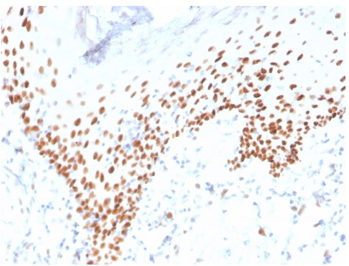 Immunohistochemistry (Formalin/PFA-fixed paraffin-embedded sections) - Anti-p40 - DeltaNp63 antibody [rTP40/3690] - BSA and Azide free (AB273142), expandable thumbnail