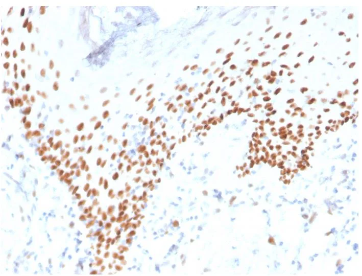 Immunohistochemistry (Formalin/PFA-fixed paraffin-embedded sections) - Anti-p40 - DeltaNp63 antibody [rTP40/3690] - BSA and Azide free (AB273142)