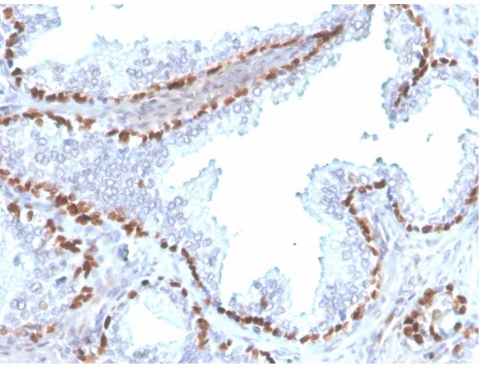 Immunohistochemistry (Formalin/PFA-fixed paraffin-embedded sections) - Anti-p40 - DeltaNp63 antibody [rTP40/3690] - BSA and Azide free (AB273142), expandable thumbnail
