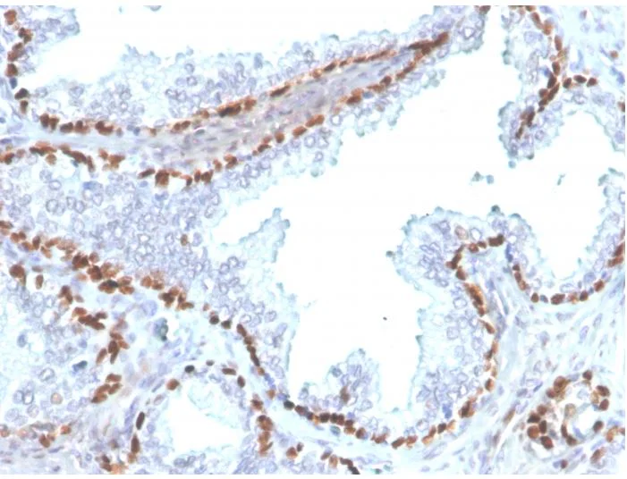 Immunohistochemistry (Formalin/PFA-fixed paraffin-embedded sections) - Anti-p40 - DeltaNp63 antibody [rTP40/3690] - BSA and Azide free (AB273142)