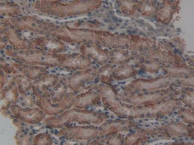 Immunohistochemistry (Formalin/PFA-fixed paraffin-embedded sections) - Anti-p40-phox antibody (AB231639)