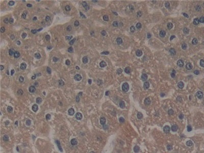 Immunohistochemistry (Formalin/PFA-fixed paraffin-embedded sections) - Anti-p40-phox antibody (AB231639)