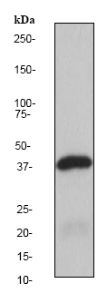 Western blot - Anti-p40-phox antibody [EP2142Y] (AB76158), expandable thumbnail