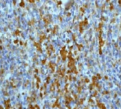 Immunohistochemistry (Formalin/PFA-fixed paraffin-embedded sections) - Anti-p40-phox antibody [EP2142Y] - BSA and Azide free (AB247448)