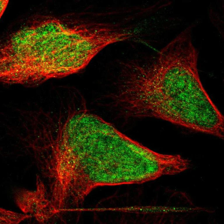 Immunocytochemistry/ Immunofluorescence - Anti-p400 antibody (AB251710)