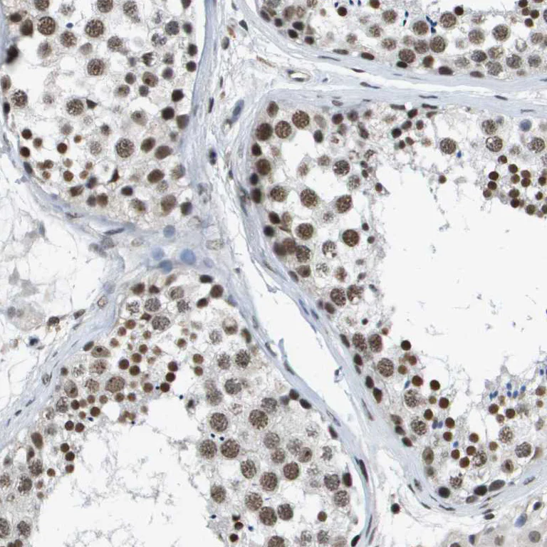 Immunohistochemistry (Formalin/PFA-fixed paraffin-embedded sections) - Anti-p400 antibody (AB251710)
