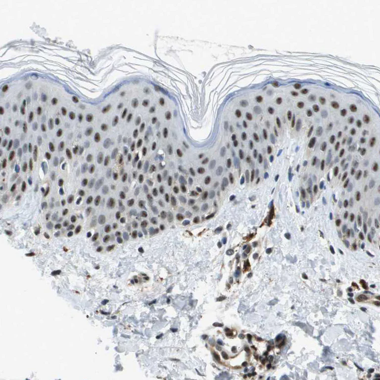 Immunohistochemistry (Formalin/PFA-fixed paraffin-embedded sections) - Anti-p400 antibody (AB251710)