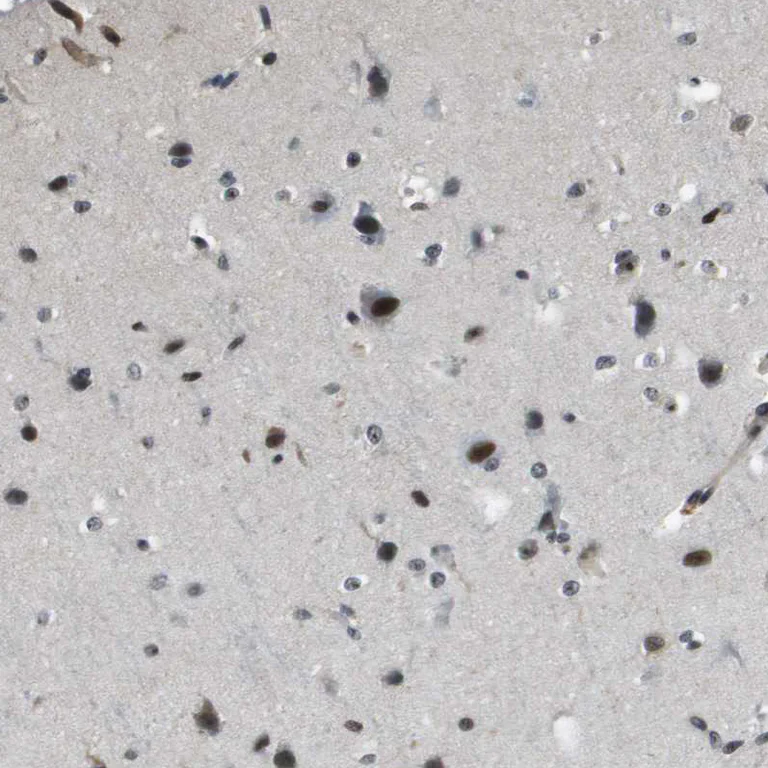 Immunohistochemistry (Formalin/PFA-fixed paraffin-embedded sections) - Anti-p400 antibody (AB251710)