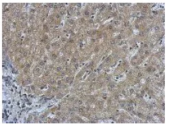 Immunohistochemistry (Formalin/PFA-fixed paraffin-embedded sections) - Anti-P4HA1 antibody (AB127564)