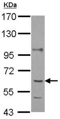 Western blot - Anti-P4HA1 antibody (AB127564)