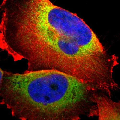 Immunocytochemistry/ Immunofluorescence - Anti-P4HA1 antibody (AB244302)