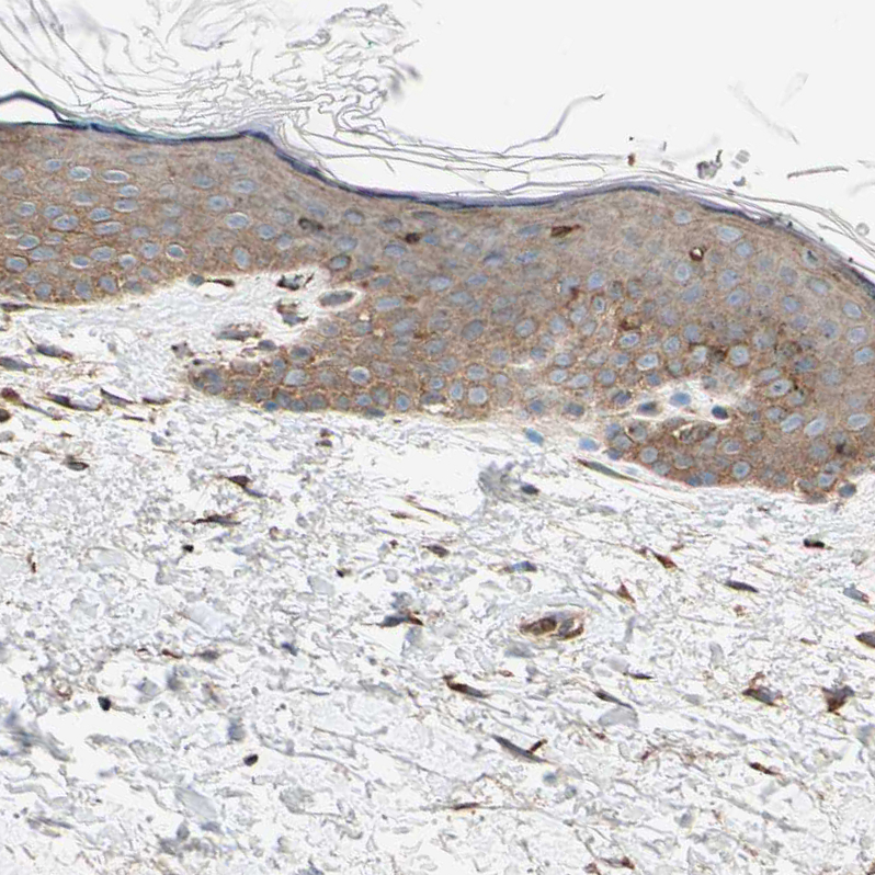 Immunohistochemistry (Formalin/PFA-fixed paraffin-embedded sections) - Anti-P4HA1 antibody (AB244302)