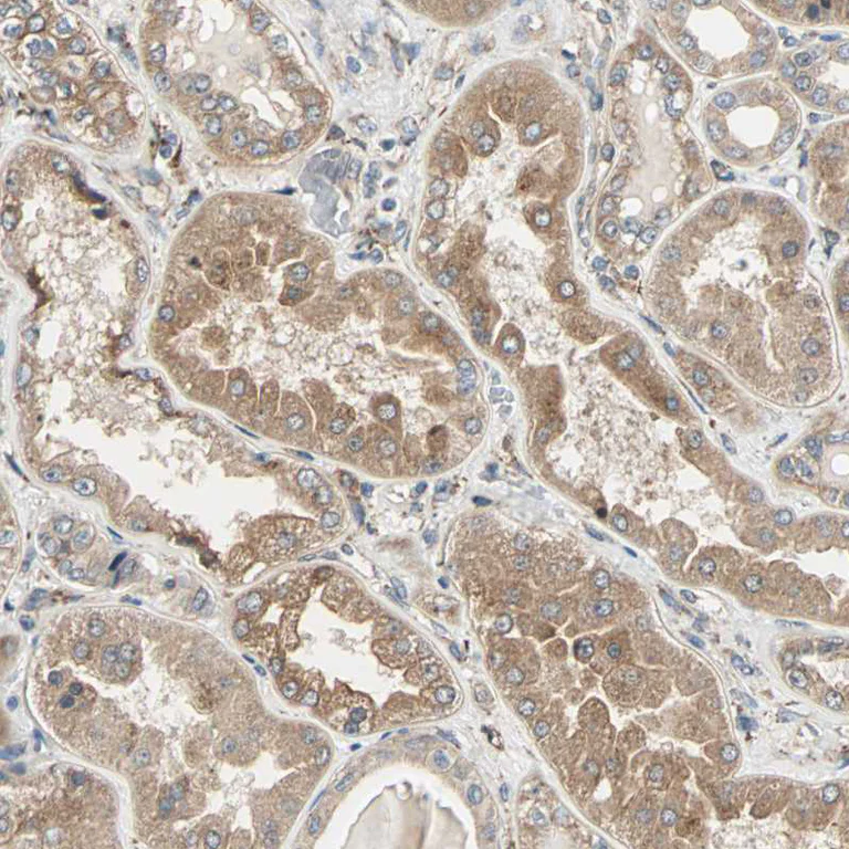 Immunohistochemistry (Formalin/PFA-fixed paraffin-embedded sections) - Anti-P4HA1 antibody (AB244302)