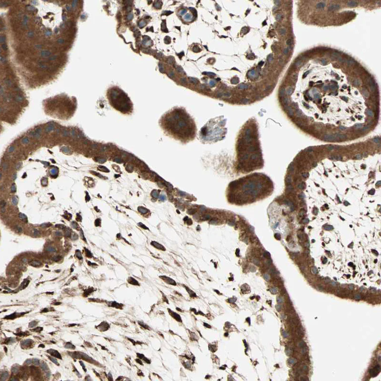 Immunohistochemistry (Formalin/PFA-fixed paraffin-embedded sections) - Anti-P4HA1 antibody (AB244302)