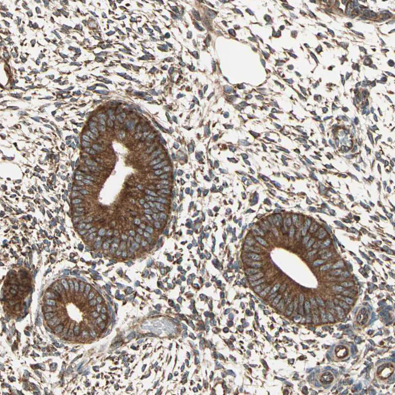 Immunohistochemistry (Formalin/PFA-fixed paraffin-embedded sections) - Anti-P4HA1 antibody (AB244302)