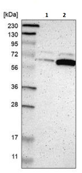 Western blot - Anti-P4HA1 antibody (AB244302)