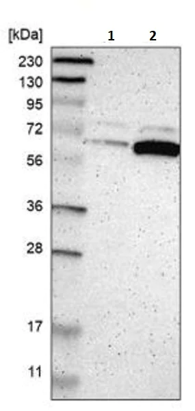 Western blot - Anti-P4HA1 antibody (AB244302)