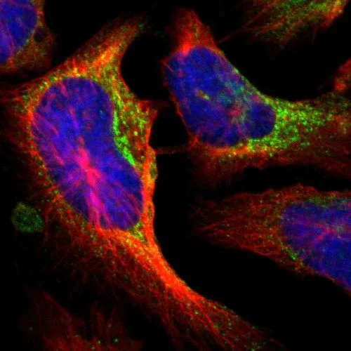 Immunocytochemistry/ Immunofluorescence - Anti-P4HA1 antibody (AB244400)
