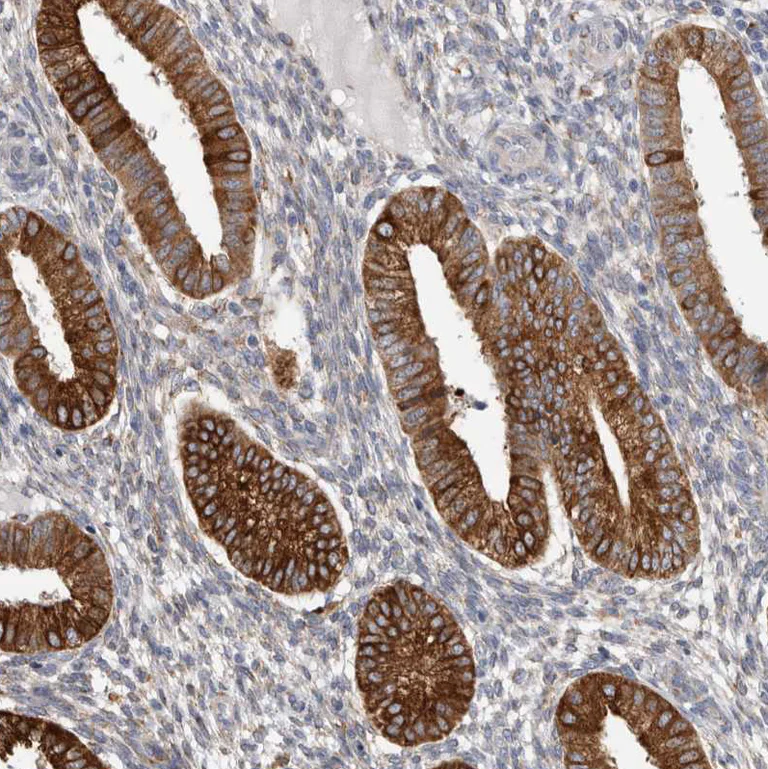 Immunohistochemistry (Formalin/PFA-fixed paraffin-embedded sections) - Anti-P4HA1 antibody (AB244400)