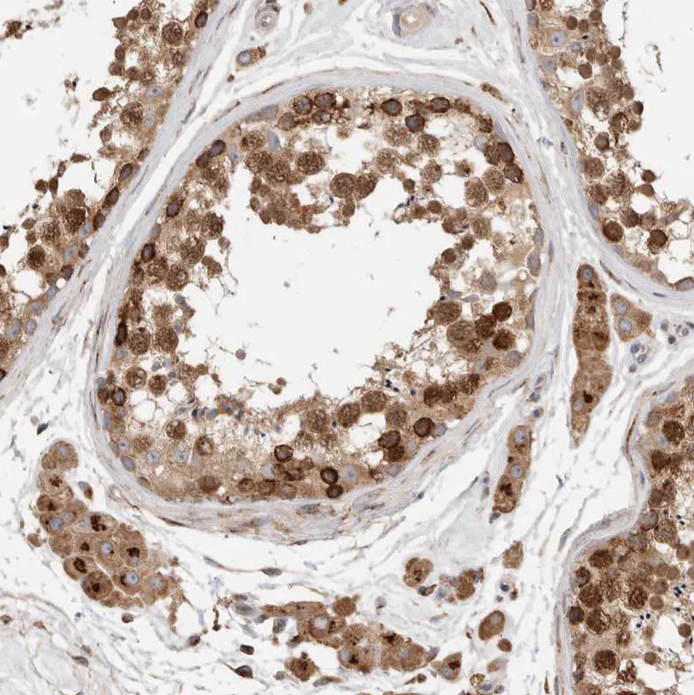 Immunohistochemistry (Formalin/PFA-fixed paraffin-embedded sections) - Anti-P4HA1 antibody (AB244400)