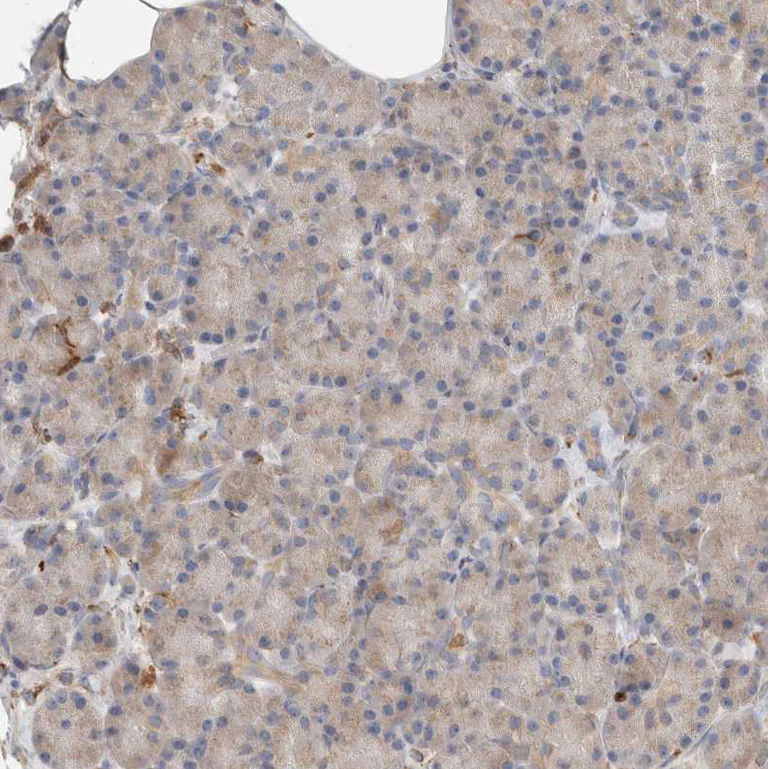 Immunohistochemistry (Formalin/PFA-fixed paraffin-embedded sections) - Anti-P4HA1 antibody (AB244400)