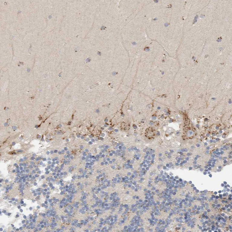 Immunohistochemistry (Formalin/PFA-fixed paraffin-embedded sections) - Anti-P4HA1 antibody (AB244400)