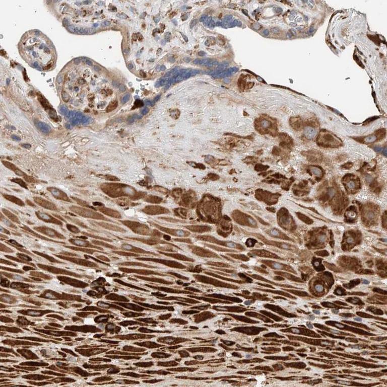Immunohistochemistry (Formalin/PFA-fixed paraffin-embedded sections) - Anti-P4HA1 antibody (AB244400)