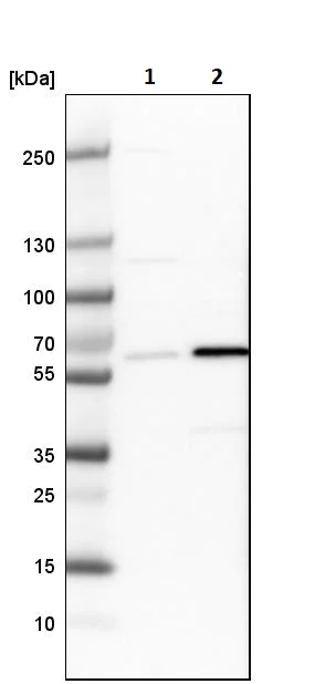 Western blot - Anti-P4HA1 antibody (AB244400)