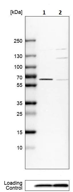Western blot - Anti-P4HA1 antibody (AB244400)