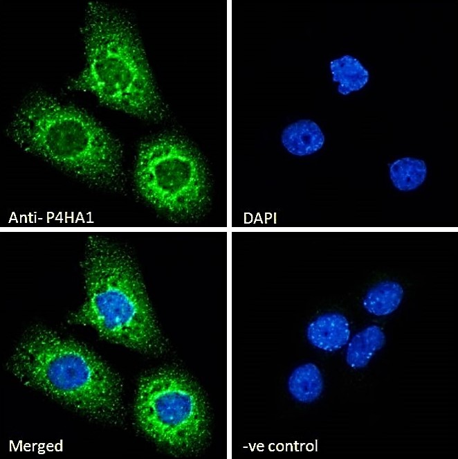 Immunocytochemistry - Anti-P4HA1 antibody (AB59497)