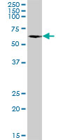 Western blot - Anti-P4HA1 antibody (AB88881)