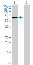 Western blot - Anti-P4HA1 antibody (AB88881)