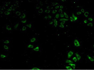 Immunocytochemistry/ Immunofluorescence - Anti-P4HA2 antibody (AB233197), expandable thumbnail