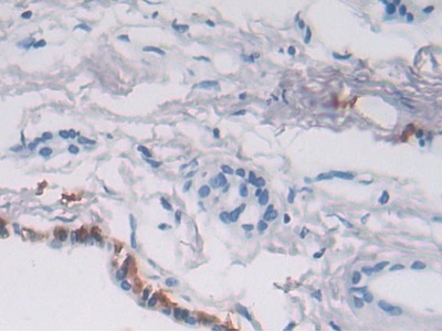 Immunohistochemistry (Formalin/PFA-fixed paraffin-embedded sections) - Anti-P4HA2 antibody (AB233197), expandable thumbnail