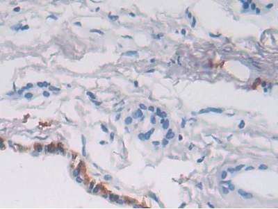 Immunohistochemistry (Formalin/PFA-fixed paraffin-embedded sections) - Anti-P4HA2 antibody (AB233197)