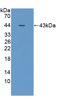 Western blot - Anti-P4HA2 antibody (AB233197), expandable thumbnail