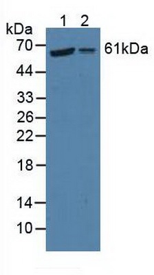Western blot - Anti-P4HA2 antibody (AB233197), expandable thumbnail