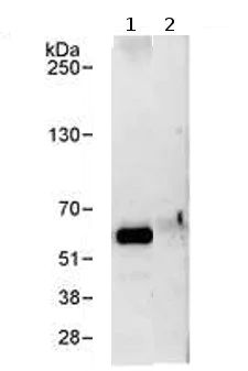 Immunoprecipitation - Anti-P4HA2 antibody (AB70887)