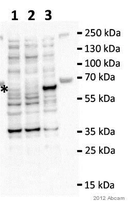 Western blot - Anti-P4HA2 antibody (AB70887)