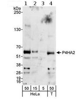 Western blot - Anti-P4HA2 antibody (AB70887)