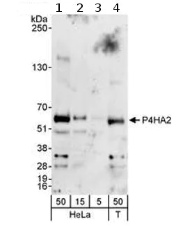 Western blot - Anti-P4HA2 antibody (AB70887)