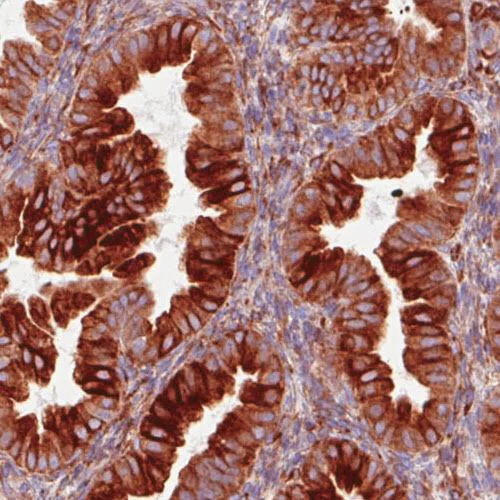 Immunohistochemistry (Formalin/PFA-fixed paraffin-embedded sections) - Anti-P4HA2 antibody [CL0351] (AB211527)