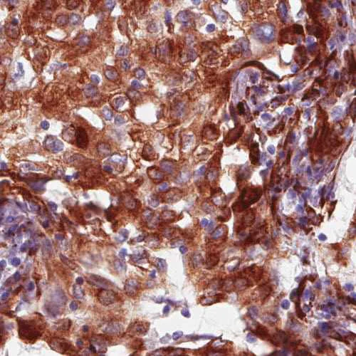 Immunohistochemistry (Formalin/PFA-fixed paraffin-embedded sections) - Anti-P4HA2 antibody [CL0351] (AB211527)